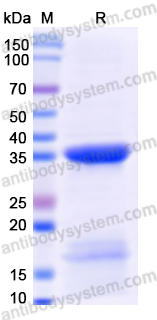 Recombinant Human VDAC1 Protein, N-His