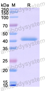 Recombinant Human CD332/FGFR2 Protein, N-His