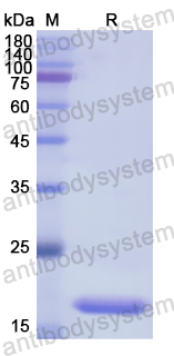 Recombinant Human BGN Protein, N-His