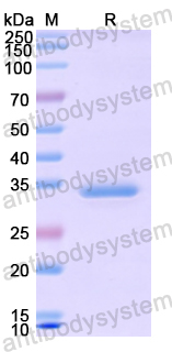 Recombinant Human ERBB3 Protein, N-His