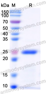 Recombinant Human COMT Protein, N-His