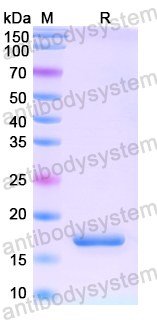 Recombinant Human KCNA3 Protein, N-His