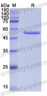 Recombinant Human LPO Protein, N-His