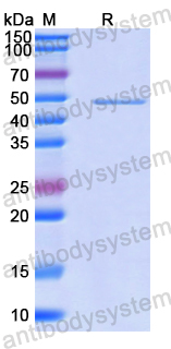 Recombinant Human PAICS Protein, N-His