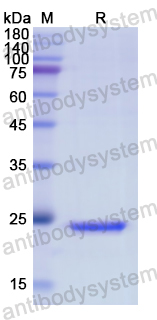 Recombinant Human ACHE Protein, N-His