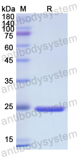 Recombinant Human IDS Protein, N-His