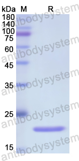 Recombinant Human ENPP1 Protein, N-His