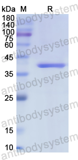 Recombinant Human CD334/FGFR4 Protein, N-His