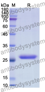 Recombinant Human ALAS2 Protein, N-His