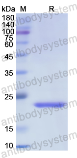 Recombinant Human FDXR Protein, N-His