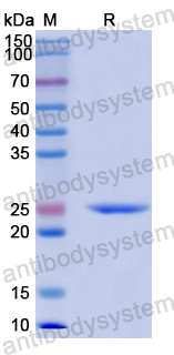 Recombinant Human CD333/FGFR3 Protein, N-His