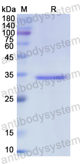 Recombinant Human Calretinin/CALB2 Protein, N-His