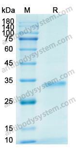 Recombinant Human IGFBP4 Protein, N-His