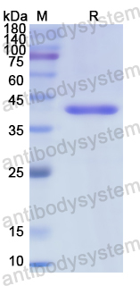 Recombinant Human TGM1 Protein, N-His