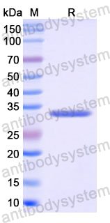 Recombinant Human CA4 Protein, N-His