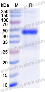 Recombinant Human FECH Protein, N-His