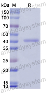 Recombinant Human PROZ Protein, N-GST