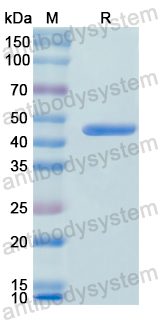 Recombinant Human MMP8 Protein, N-His