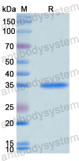 Recombinant Human CD206/MRC1 Protein, N-His