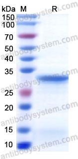 Recombinant Human CES1 Protein, N-His