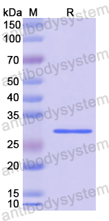 Recombinant Human PTGS1 Protein, N-His