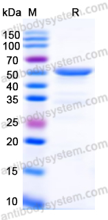 Recombinant Human CD49f/ITGA6 Protein, N-His