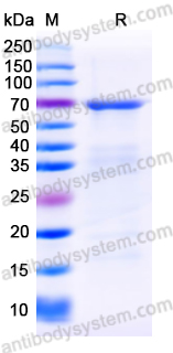 Recombinant Human CD49f/ITGA6 Protein, N-His