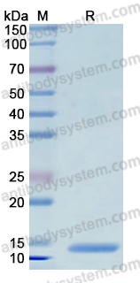 Recombinant Human S100A1 Protein, N-His