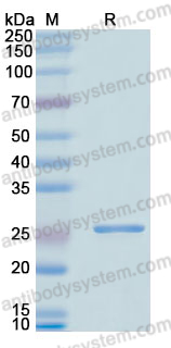 Recombinant Human ME2 Protein, N-His