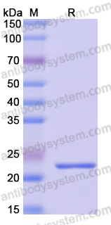 Recombinant Human GLDC Protein, N-His