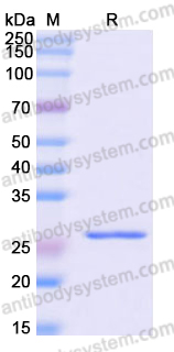 Recombinant Human WARS1 Protein, N-His