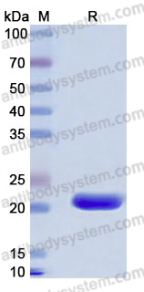 Recombinant Human CBLN1 Protein, N-His