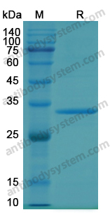 Recombinant Human JAK1 Protein, N-His