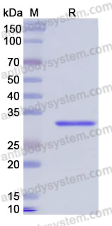 Recombinant Human PTPRB Protein, N-His