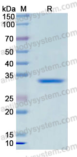 Recombinant Human LORICRIN Protein, N-GST