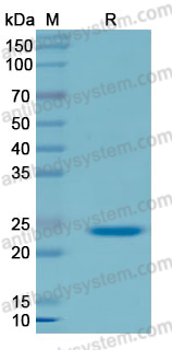 Recombinant Human SP100 Protein, N-His