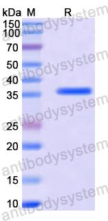 Recombinant Human MCC Protein, N-GST & C-His