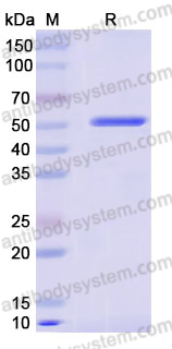 Recombinant Human AHCY Protein, N-His