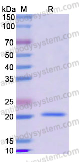 Recombinant Human CFL1 Protein, N-His