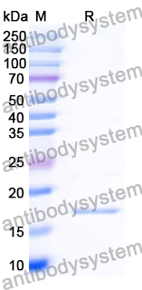 Recombinant Human BDNF Protein, N-His