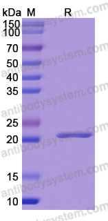 Recombinant Human EIF4B Protein, N-His-SUMO