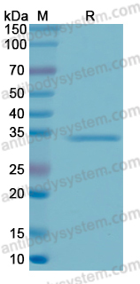 Recombinant Human GATA2 Protein, N-His