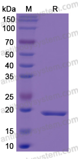 Recombinant Human DTYMK Protein, N-His