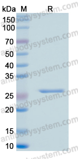 Recombinant Human RRM1 Protein, N-His