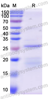 Recombinant Human PRTN3 Protein, N-His