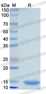 Recombinant Human GPT Protein, N-His