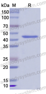 Recombinant Human MMP11 Protein, N-His