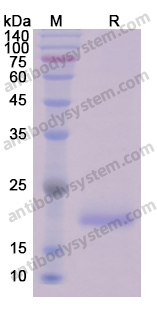 Recombinant Human CCND1 Protein, N-His