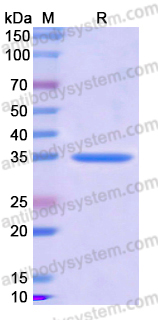 Recombinant Human CRHBP Protein, N-His