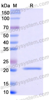 Recombinant Human CYP3A7 Protein, N-His